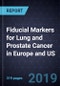 Fiducial Markers for Lung and Prostate Cancer in Europe and US, Forecast to 2022 - Product Thumbnail Image