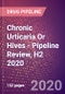 Chronic Urticaria Or Hives - Pipeline Review, H2 2020 - Product Thumbnail Image
