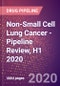 Non-Small Cell Lung Cancer - Pipeline Review, H1 2020 - Product Thumbnail Image
