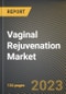 Vaginal Rejuvenation Market Research Report by Treatment Type, End User, State - Cumulative Impact of COVID-19, Russia Ukraine Conflict, and High Inflation - United States Forecast 2023-2030 - Product Image