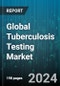 Global Tuberculosis Testing Market by Test (Culture Based Tests, Drug Susceptibility Testing, Nucleic Acid Testing), End User (Hospital, Laboratories) - Forecast 2024-2030 - Product Image
