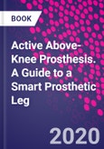 Active Above-Knee Prosthesis. A Guide to a Smart Prosthetic Leg- Product Image