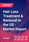 Hair Loss Treatment & Removal in the US - Industry Market Research Report - Product Thumbnail Image