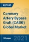 Coronary Artery Bypass Graft (CABG) Global Market Insights 2021, Analysis and Forecast to 2026, by Manufacturers, Regions, Technology, Application, Product Type - Product Image