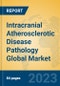Intracranial Atherosclerotic Disease Pathology Global Market Insights 2023, Analysis and Forecast to 2028, by Manufacturers, Regions, Technology, Application, Product Type - Product Image