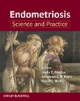 Endometriosis. Science and Practice. Edition No. 1- Product Image