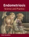 Endometriosis. Science and Practice. Edition No. 1 - Product Image