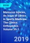 Meniscus Injuries, An Issue of Clinics in Sports Medicine. The Clinics: Orthopedics Volume 39-1 - Product Thumbnail Image