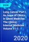 Lung Cancer, Part I, An Issue of Clinics in Chest Medicine. The Clinics: Internal Medicine Volume 41-1 - Product Thumbnail Image