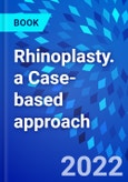 Rhinoplasty. a Case-based approach- Product Image