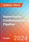 Hypertrophic Cardiomyopathy - Pipeline Insight, 2022 - Product Image