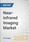 Near-Infrared Imaging (NIR) Market by Product (Fluorescence Imaging, Reagents), Application (Preclinical, Clinical, Medical), Procedure (Cancer, GIT, Plastic Surgery), End-User (Hospital, Clinics, Researchers, Pharma-Biotech) - Global Forecast to 2026 - Product Image