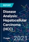 Disease Analysis: Hepatocellular Carcinoma (HCC) - Product Thumbnail Image