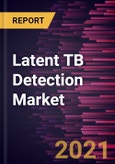 Latent TB Detection Market Forecast to 2027 - COVID-19 Impact and Global Analysis By Test; End User and Geography- Product Image
