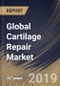 Global Cartilage Repair Market (2018 - 2024) - Product Thumbnail Image