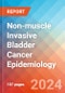 Non-muscle Invasive Bladder Cancer (NMIBC) - Epidemiology Forecast - 2034 - Product Image