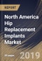 North America Hip Replacement Implants Market (2019-2025) - Product Thumbnail Image