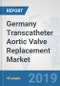 Germany Transcatheter Aortic Valve Replacement Market: Prospects, Trends Analysis, Market Size and Forecasts up to 2025 - Product Image
