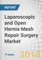 Laparoscopic and Open Hernia Mesh Repair Surgery Market by Mesh Fixator (Glue And Tack Applicators), Country (US, Canada, Germany, France, UK, Italy, Spain, Japan, China, and India) - Forecast to 2022 - Product Thumbnail Image