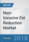 Non-Invasive Fat Reduction Market: Global Industry Analysis, Trends, Market Size and Forecasts up to 2024 - Product Thumbnail Image