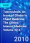 Tuberculosis, An Issue of Clinics in Chest Medicine. The Clinics: Internal Medicine Volume 30-4 - Product Image