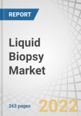 Liquid Biopsy Market by Product (Assay Kits, Instruments, Service), Circulating Biomarkers (CTC, ctDNA), Technology (NGS, PCR), Application (Cancer (Lung, Breast, Prostate), Non-Cancer), End User (Reference Lab, Hospitals) - Global Forecast to 2026- Product Image