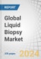 Global Liquid Biopsy Market by Product & Service (Kits, Instruments), Circulating Biomarker (CTC, ctDNA, cfDNA), Technology (NGS, PCR), Application (Cancer (Lung, Breast, Prostate), Non-cancer (NIPT, Infectious)), Sample Type (Blood) - Forecast to 2029 - Product Image