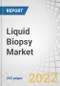Liquid Biopsy Market by Product (Assay Kits, Instruments), Circulating Biomarkers (CTC, ctDNA), Technology (NGS, PCR), Application (Cancer (Lung, Breast), Non-Cancer), Sample Type (Blood), End User (Reference Lab, Hospitals) - Global Forecast to 2027 - Product Image