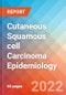Cutaneous Squamous cell Carcinoma (CsCC) - Epidemiology Forecast to 2032 - Product Thumbnail Image
