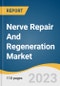 Nerve Repair and Regeneration Market Size, Share & Trends Analysis Report by Product (Biomaterials, Neurostimulation & Neuromodulation Devices), by Surgery, by Region, and Segment Forecasts, 2022-2030 - Product Image