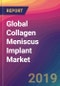 Global Collagen Meniscus Implant Market Size, Market Share, Application Analysis, Regional Outlook, Growth Trends, Key Players, Competitive Strategies and Forecasts, 2019 To 2027 - Product Thumbnail Image