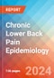 Chronic Lower Back Pain (CLBP) - Epidemiology Forecast to 2032 - Product Image