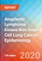 Anaplastic Lymphoma Kinase Non Small Cell Lung Cancer (ALK-NSCLC) - Epidemiology Forecast to 2030 - Product Thumbnail Image