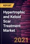 Hypertrophic and Keloid Scar Treatment Market Forecast to 2027 - COVID-19 Impact and Global Analysis By Scar Type, Product Type, and End User, and Geography - Product Thumbnail Image