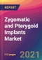 Zygomatic and Pterygoid Implants Market Size, Market Share, Application Analysis, Regional Outlook, Growth Trends, Key Players, Competitive Strategies and Forecasts, 2021 To 2029 - Product Image