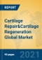 Cartilage Repair&Cartilage Regeneration Global Market Insights 2021, Analysis and Forecast to 2026, by Manufacturers, Regions, Technology, Application, Product Type - Product Image