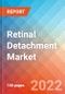 Retinal Detachment - Market Insights, Competitive Landscape and Market Forecast-2027 - Product Image