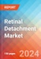 Retinal Detachment - Market Insights, Competitive Landscape and Market Forecast-2027 - Product Thumbnail Image