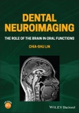 Dental Neuroimaging. The Role of the Brain in Oral Functions. Edition No. 1- Product Image