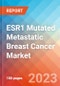 ESR1 Mutated Metastatic Breast Cancer - Market Insight, Epidemiology and Market Forecast -2032 - Product Image