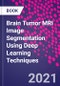 Brain Tumor MRI Image Segmentation Using Deep Learning Techniques - Product Thumbnail Image