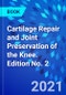 Cartilage Repair and Joint Preservation of the Knee. Edition No. 2 - Product Image