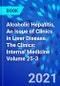 Alcoholic Hepatitis, An Issue of Clinics in Liver Disease. The Clinics: Internal Medicine Volume 25-3 - Product Thumbnail Image