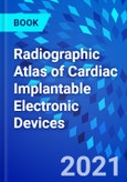 Radiographic Atlas of Cardiac Implantable Electronic Devices- Product Image