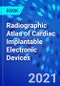 Radiographic Atlas of Cardiac Implantable Electronic Devices - Product Image