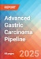 Advanced Gastric Carcinoma - Pipeline Insight, 2024 - Product Thumbnail Image