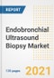 Endobronchial Ultrasound Biopsy Market Growth Analysis and Insights, 2021: Trends, Market Size, Share Outlook and Opportunities by Type, Application, End Users, Countries and Companies to 2028 - Product Image