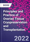 Principles and Practice of Ovarian Tissue Cryopreservation and Transplantation- Product Image