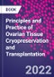Principles and Practice of Ovarian Tissue Cryopreservation and Transplantation - Product Image