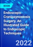 Endoscopic Craniosynostosis Surgery. An Illustrated Guide to Endoscopic Techniques- Product Image
